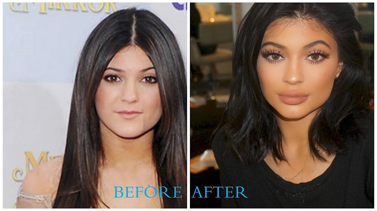 Kylie Jenner before Plastic Surgery. Знаменитость